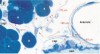 Celulele interstitiale Cajal - 